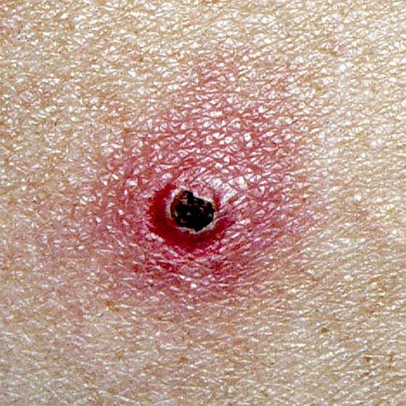 Как мозг человека защищается от кошачьих паразитов: открытие неврологов