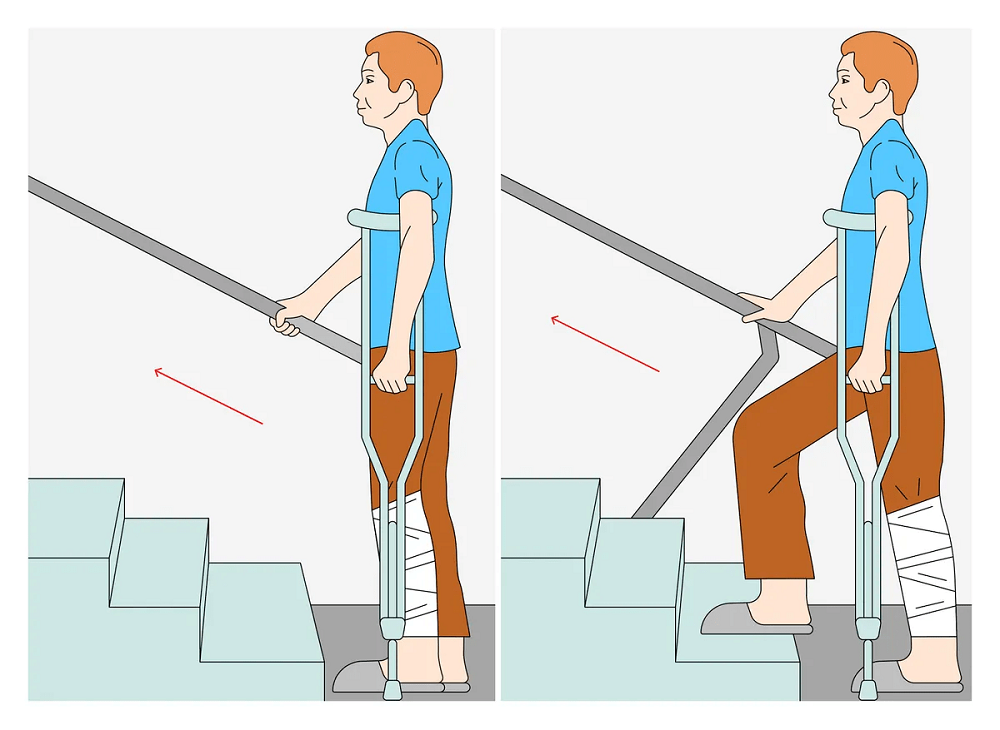 Даже на обычных костылях нужно учиться ходить. Чтобы подняться по лестнице с поручнями, надо взять оба костыля под одну руку, свободной рукой взяться за поручень, поставить на верхнюю ступеньку сначала здоровую ногу, затем костыли, а после подтянуть травмированную ногу