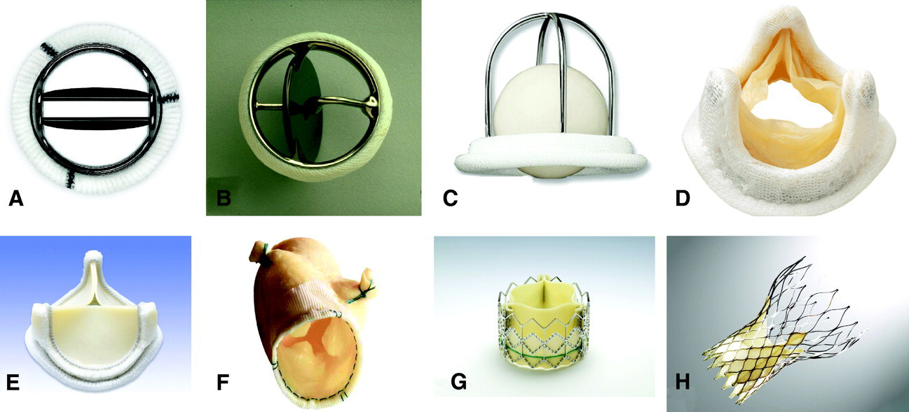 Разные искусственные клапаны сердца. A, B, C — механические, остальные — биологические. Источник: ahajournals.org