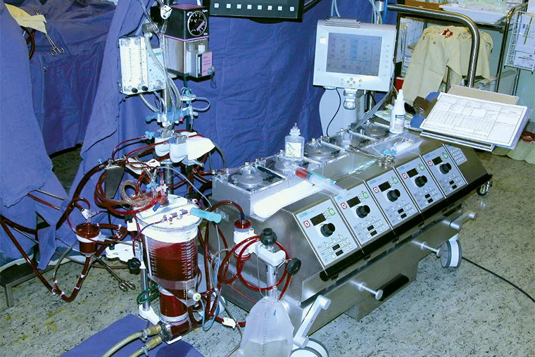 Так выглядит аппарат искусственного кровообращения, который «качает» кровь пациента во время операции вместо сердца. Источник: britannica.com