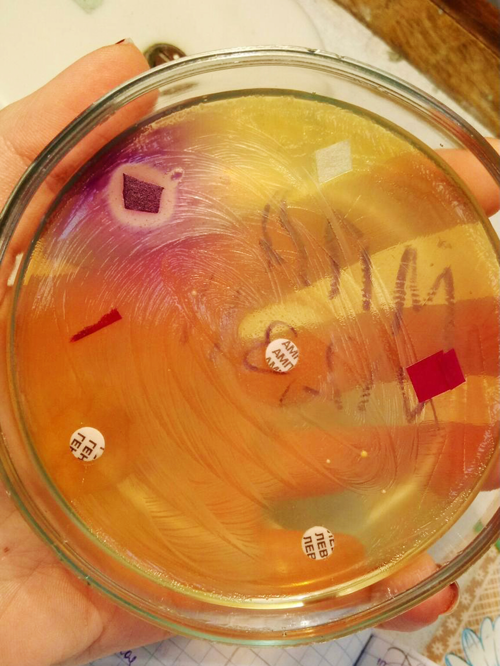 Пара по микробиологии — проверяем чувствительность микроорганизма к антибиотикам