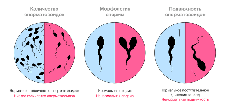 Основные параметры базовой спермограммы