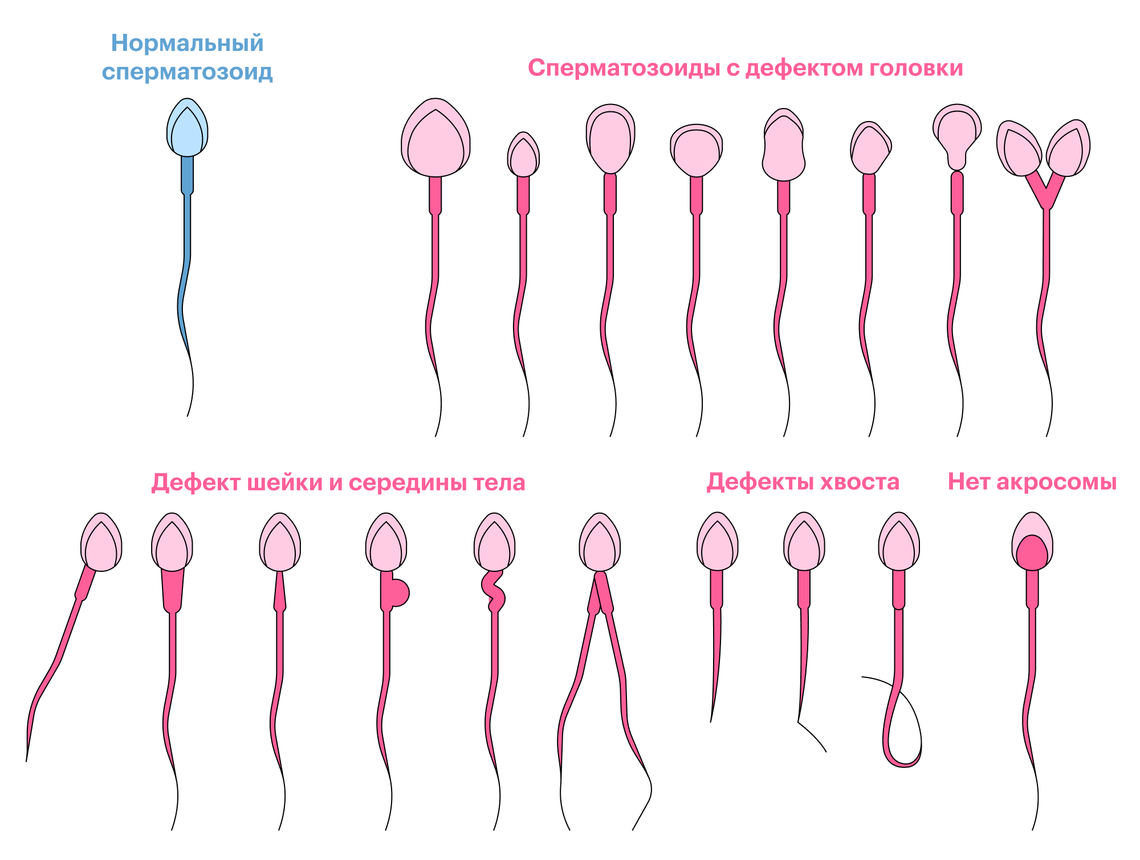Основные параметры базовой спермограммы - клиника Геном в Калининграде