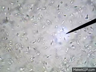 Здоровая сперма под микроскопом: видно, что почти все сперматозоиды энергично двигаются