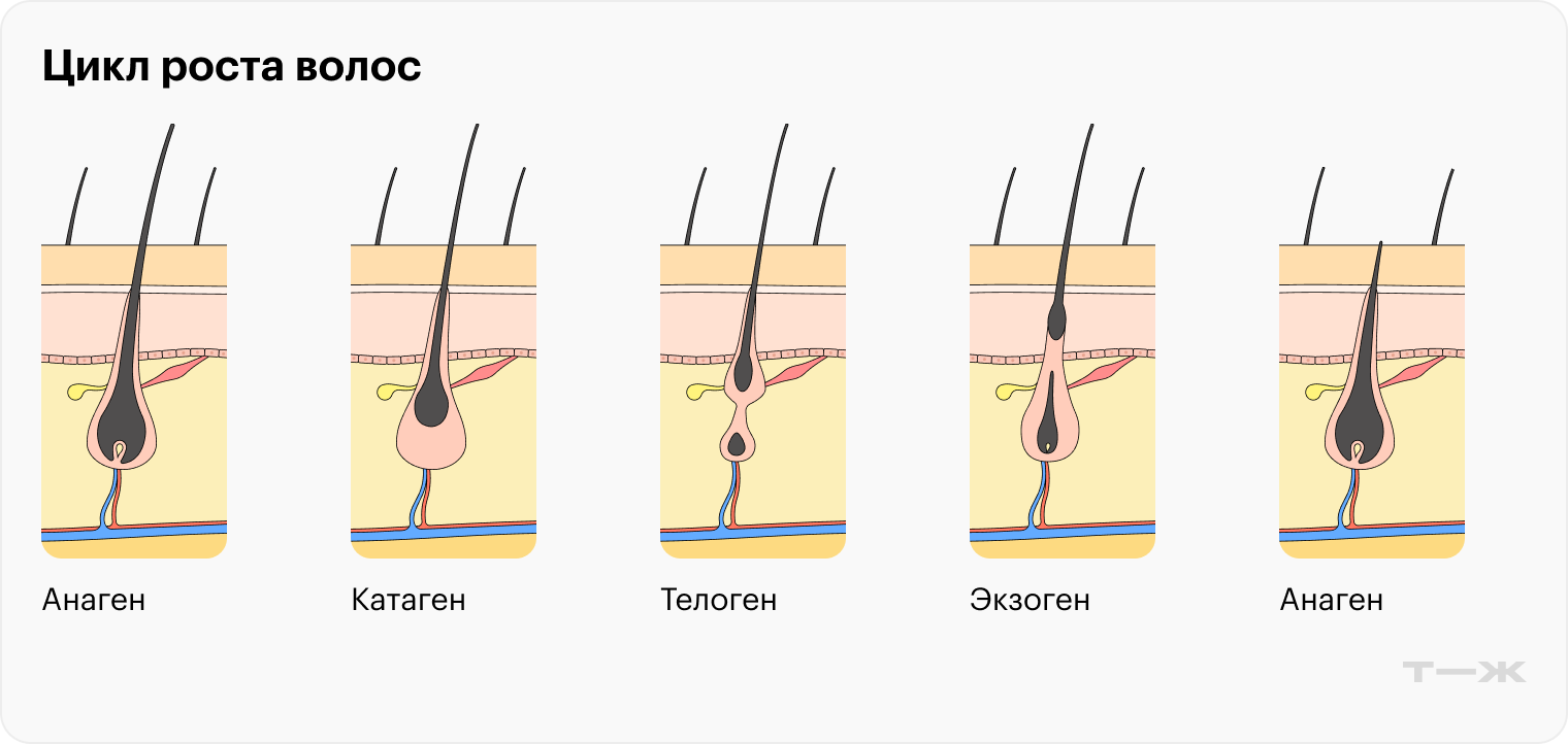 Анаген — это фаза роста, которая длится несколько лет. Затем наступает катаген — три недели перехода к фазе покоя, которую называют телоген. Телоген длится 2—3 месяца и снова сменяется анагеном: старый волос выпадает, начинает расти новый. При телогеновой алопеции волос находится в фазе покоя дольше, чем нужно