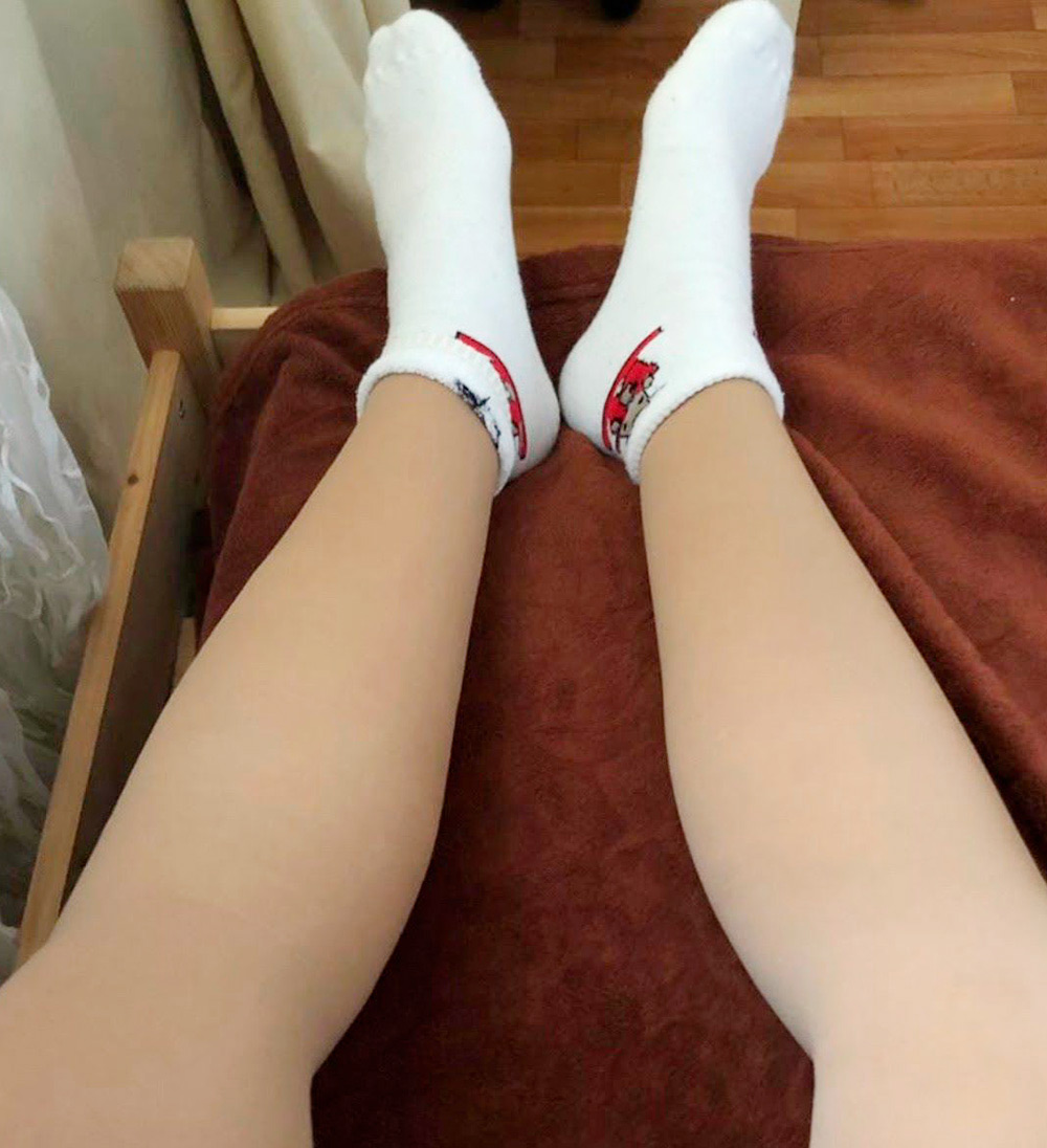 Вот так выглядят мои ноги после операции