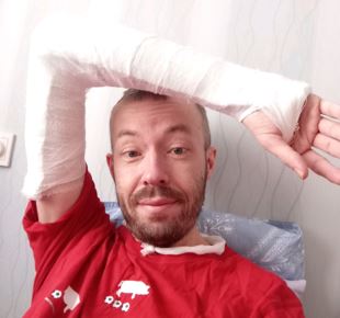 Как я сломал правую руку и потратил около 16 000 ₽ на лечение и восстановление