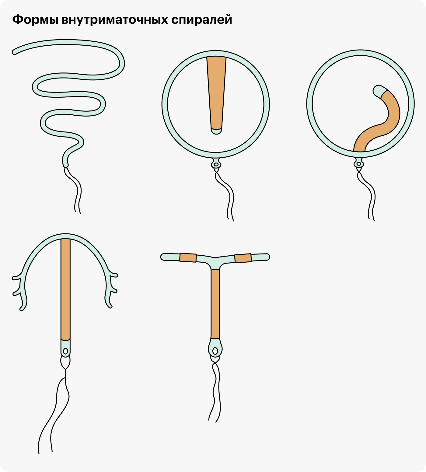 Внутриматочная спираль: сколько стоит установка, когда можно ставить после  родов и нерожавшим