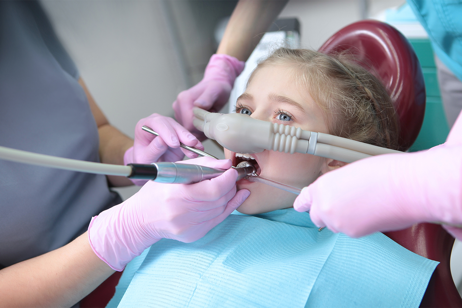 Седация веселящим газом в детской стоматологии. Фотография: RusAKphoto / Shutterstock / FOTODOM