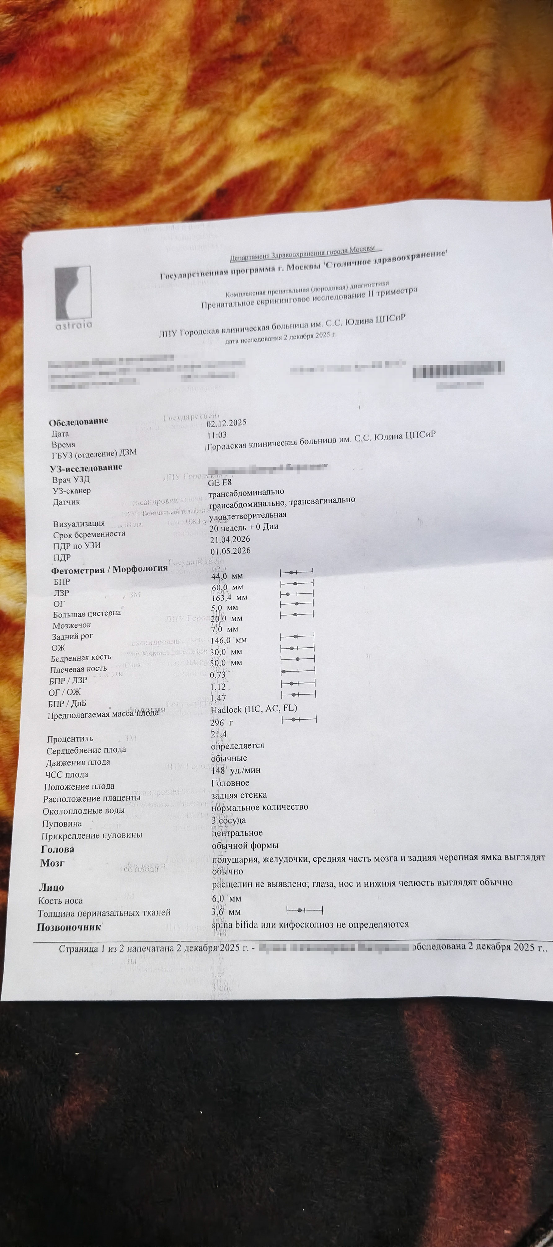 Вопрос врачу: насколько опасны пиелоэктазия и отек стопы у плода, если скрининги в норме?