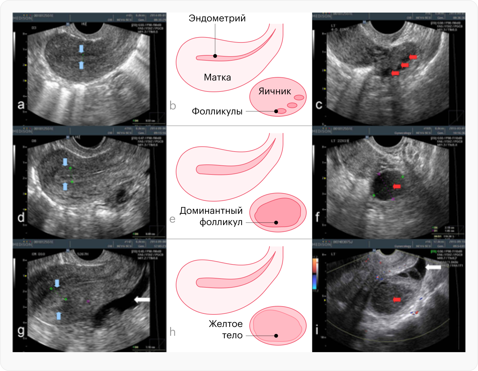 УЗИ яичника во время овуляции. Синими стрелками показано, как увеличивается толщина внутреннего слоя матки — эндометрия. Созревающий фолликул указан красными стрелками. На изображениях a, b, c — ранняя фаза созревания, d, e, f — незадолго до овуляции, g, h, i — овуляция и образование желтого тела на месте, где был фолликул. Источник: aiche.onlinelibrary.wiley.com