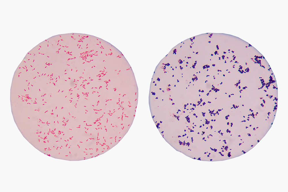 Так выглядят под микроскопом окрашенные по Граму бактерии. Слева — грамотрицательные, справа — грамположительные. Источник: Schira / Shutterstock