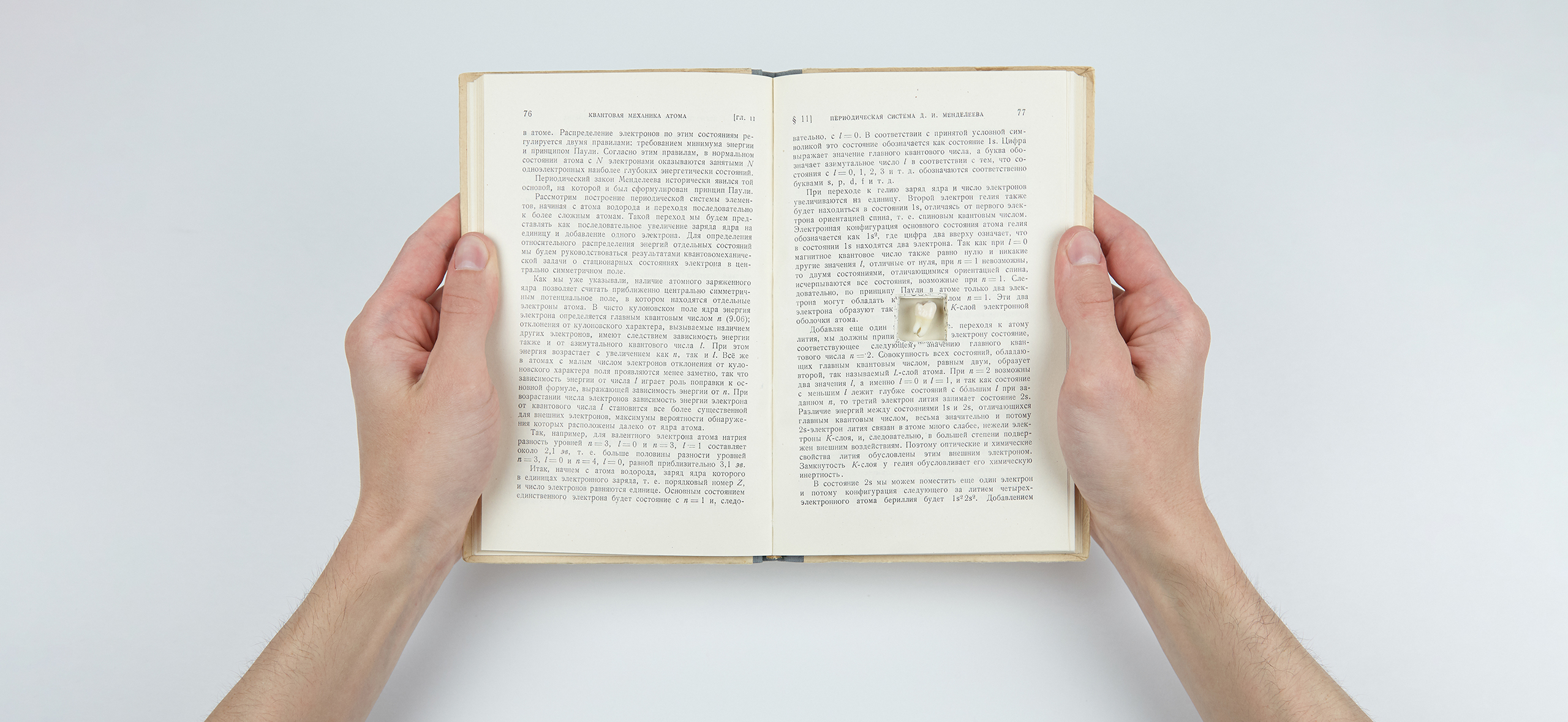 Сколько стоит вылечить зубы мудрости