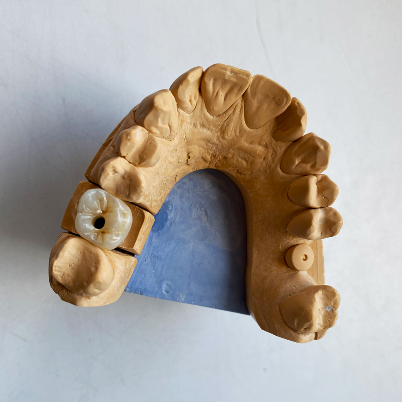 Готовый зуб из диоксида циркония